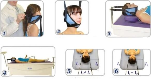 Behandlung vu Gebärmutteral Osteochondros mat Eliminatioun