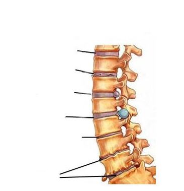 Zänn vun der Entwécklung vun Osteochondrosis