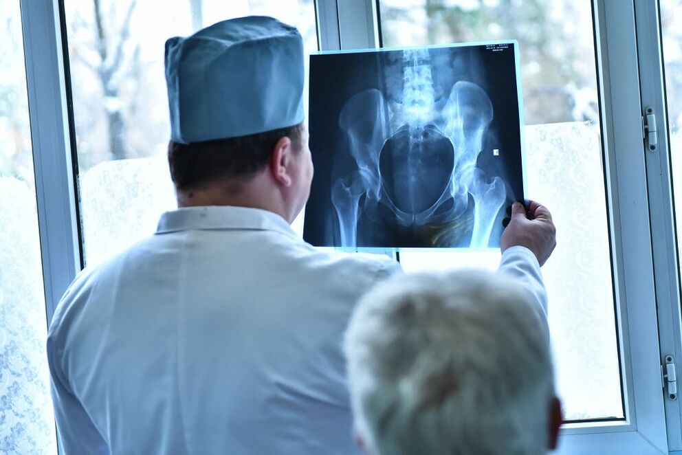 Den Dokter kuckt op e Bild vun engem Hip Gelenk mat Arthrosis